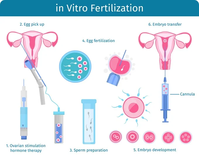 IVF Services