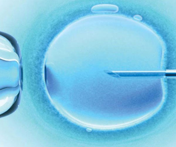 Intracytoplasmic sperm Injection