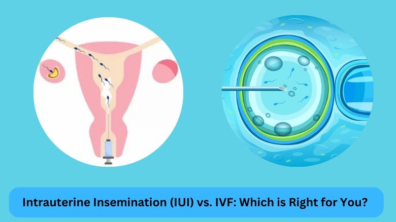 Exploring Non-Invasive Fertility Treatments Like IUI